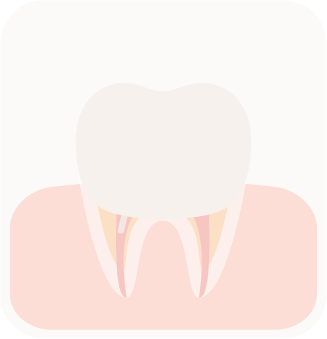 Endo 5