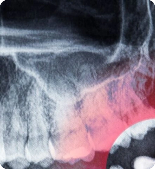 Was ist 3D - Röntgendiagnostik?