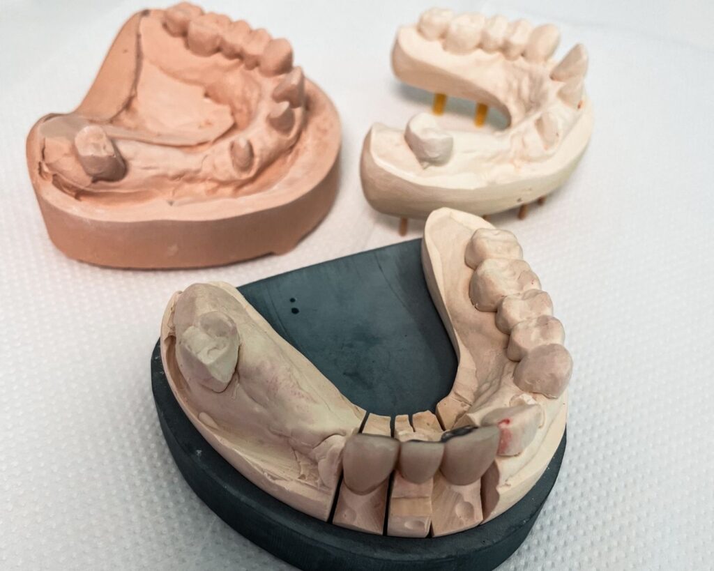 Mundschutz-Sportler Modellreihen aus Gips und Kunststoff im Dentallabor von Nova-Smile, zeigt Unterkiefer- und Oberkiefermodelle mit Zahnersatz-Referenz
